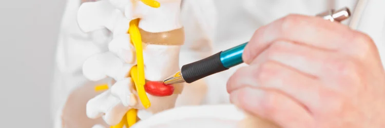 Washington DC Chiropractor Discusses Herniated Discs